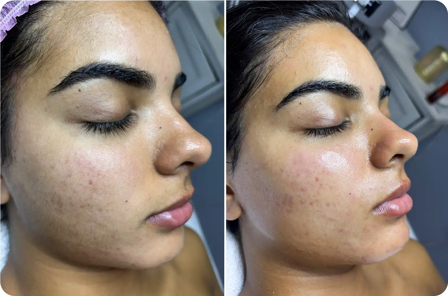 Patient Results Before and After